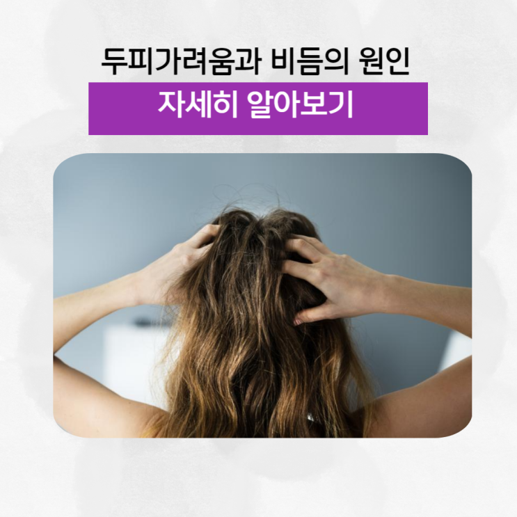 제주탈모병원에서 알려드리는 두피가려움과 비듬의 원인