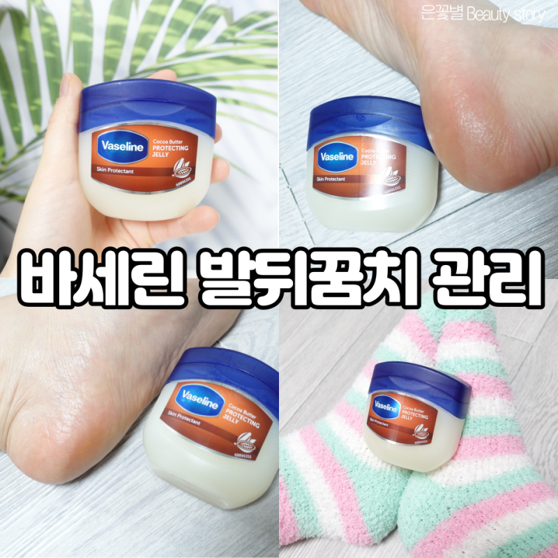 바세린 팩 효능 효과 발뒤꿈치 굳은살 각질제거
