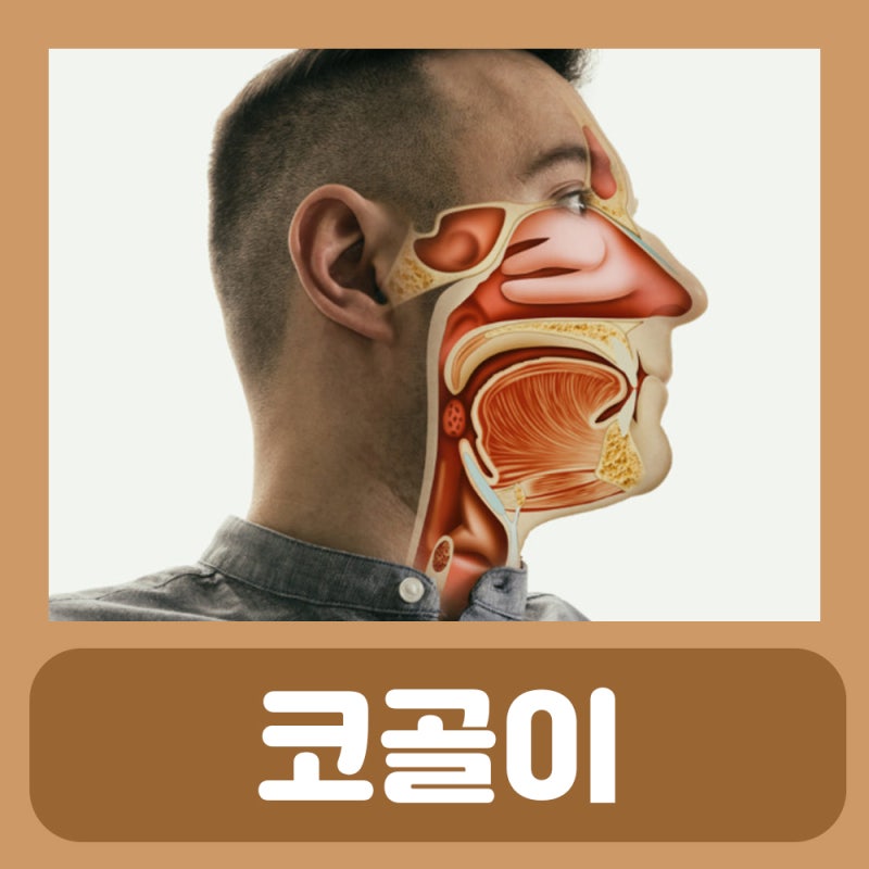 코골이 멈추는법 코골이 원인 방지 베개 기구 파사