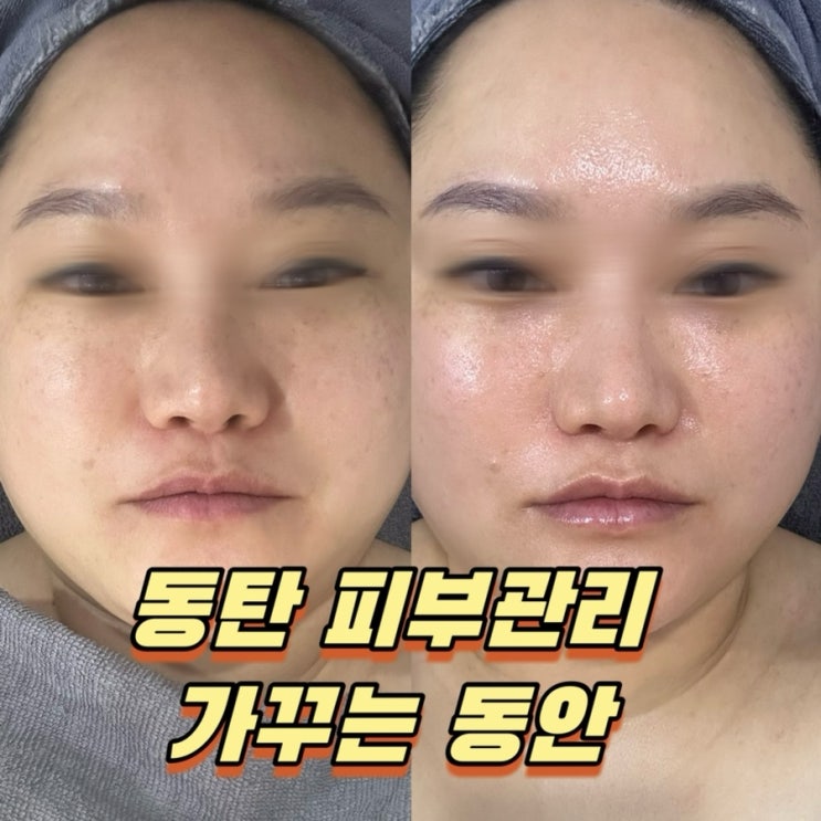  동탄피부관리 가꾸는동안 동탄반송점
