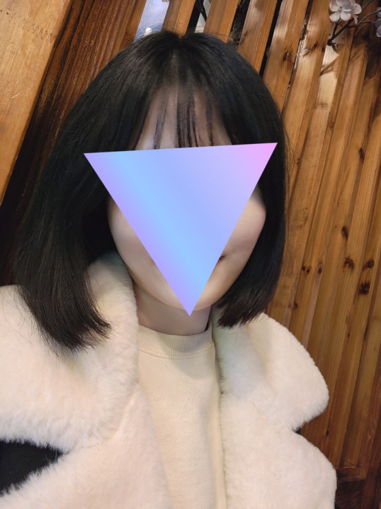  스컬트라 1, 2회차 후기 (스컬트라 전후/인모드 부작용/통증/가격)