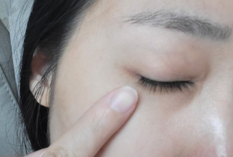 마이봄샘 안검염 눈꺼풀부음, 눈기름샘청소 방법(눈에기름)