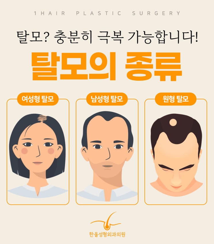  모발이식 생착률을 높이기 위한 방법은 이것!