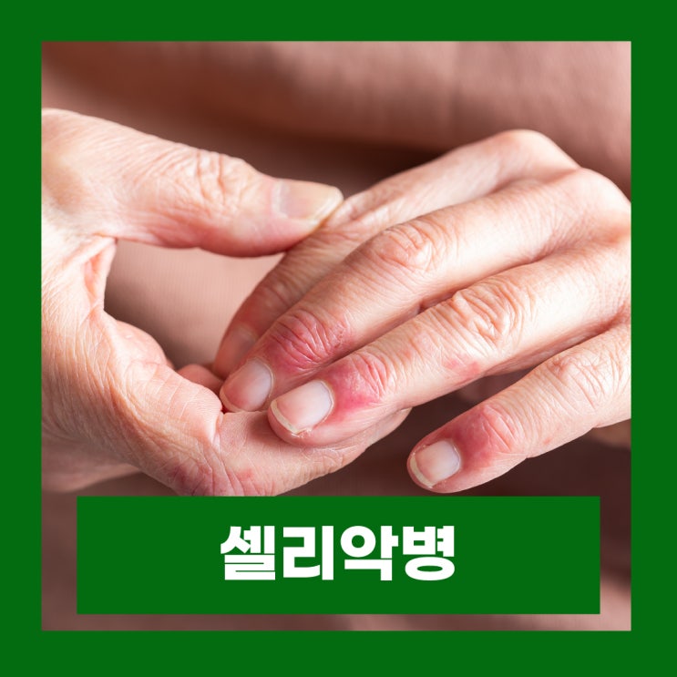  셀리악병 손가락 한포진 밀가루 알레르기 피부 증상