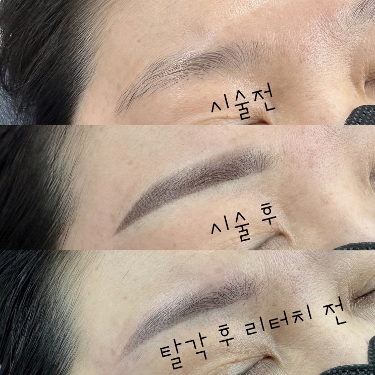  탈각후에도 자연스러운 천안 눈썹문신, 여기!