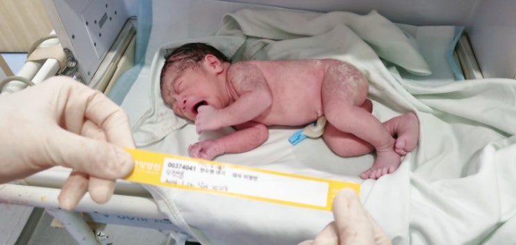  아기 태어나고 생후 10일까지 사진 정리