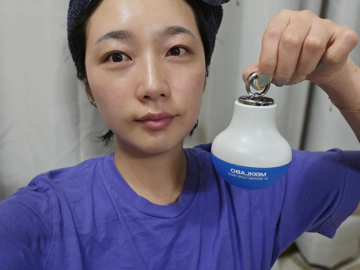 이마여드름 아크엑소좀 레이저 크림으로 관리해요