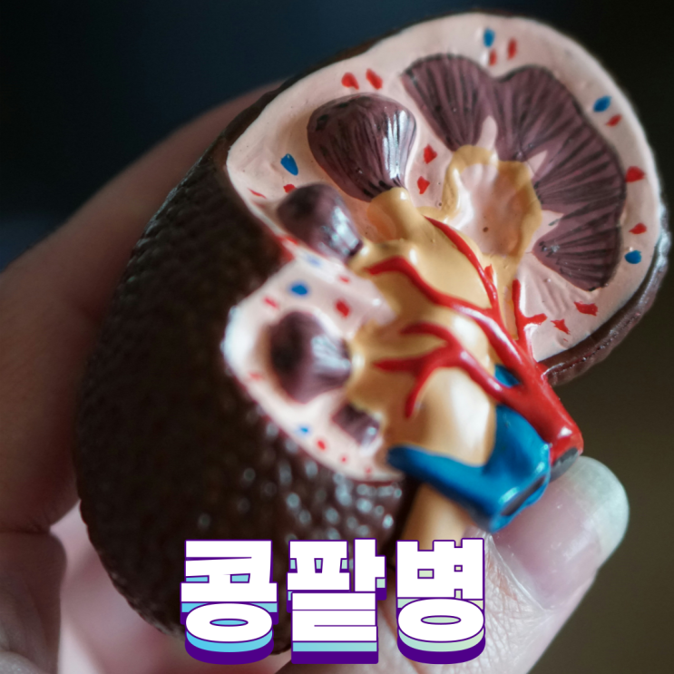 콩팥병 의심증상 요통, 혈뇨, 단백뇨, 치료