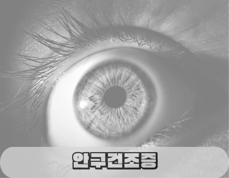  겨울철에도 사용하는 렌즈! 안구건조증 유발한다면, 예방하는 방법은?