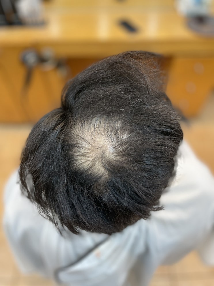  경주라고요? 남자 탈모 펌 부산 르네시떼6층미용실/ 김해가야덕천대동다대대연수영안락연제거제리하마정연지동래범일전포당감해운대초량남천용호울산양산밀양사천창원진주남해양정영도덕천하단금정장전장림