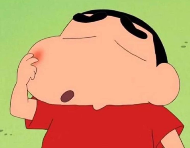  이소티논 후기 2개월차 좁쌀 여드름, 부작용, 효과