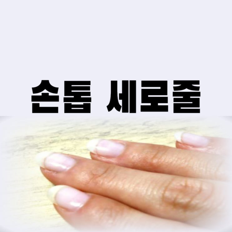  손톱 검은세로줄 흰색 세로줄 갈색세로줄 원인 흑색종 때문이라면