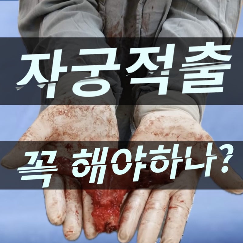 자궁선근증 비수술 하이푸 3개월 경과 관찰 과정