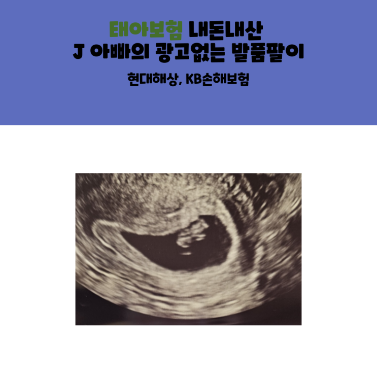 [육아] 태아보험 내돈내산 J 아빠의 광고없는 발품팔이(현대해상, KB손해보험)