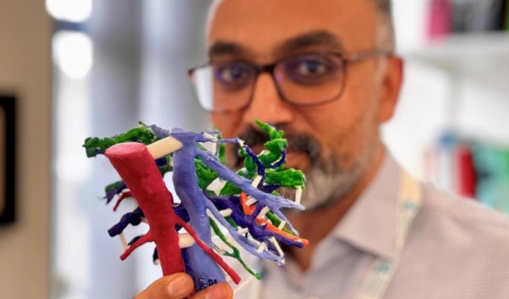 3D프린터로 제작한 종양 모델로 수술의 정밀도를 향상시키다