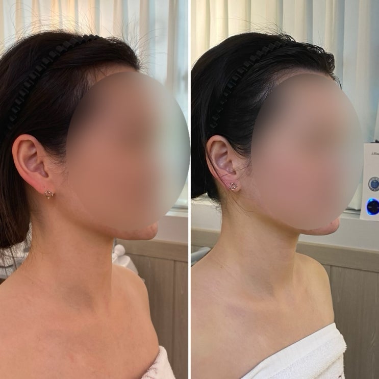  대구칠곡피부관리 더빛나스킨케어 c️ ㅣ윤곽관리의 필요성 !!!