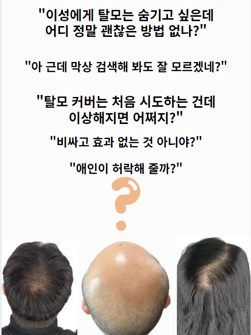  울산SMP  정수리 탈모커버 와닿지 않다면 안 오셔도 됩니다