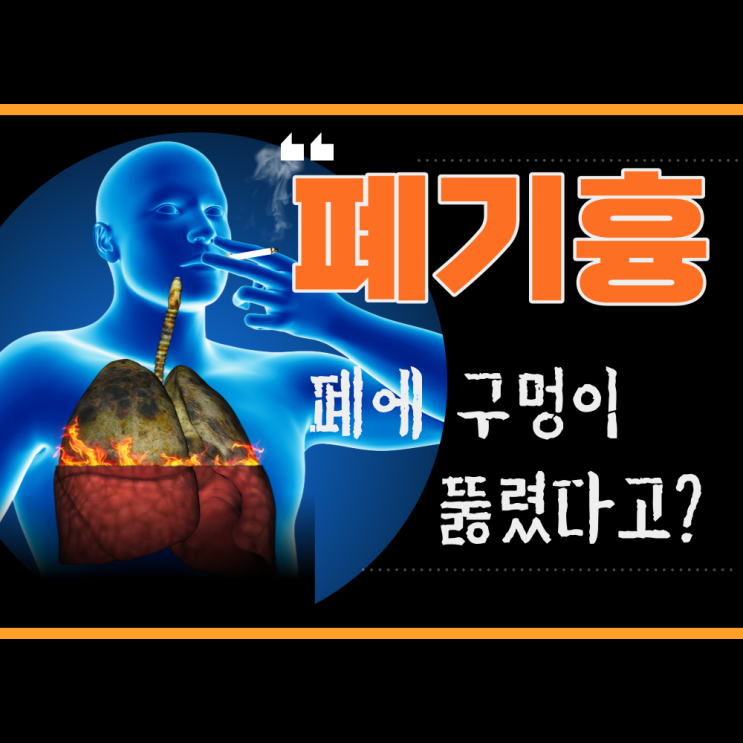 폐 기흉 원인 증상 치료 폐 구멍 예방