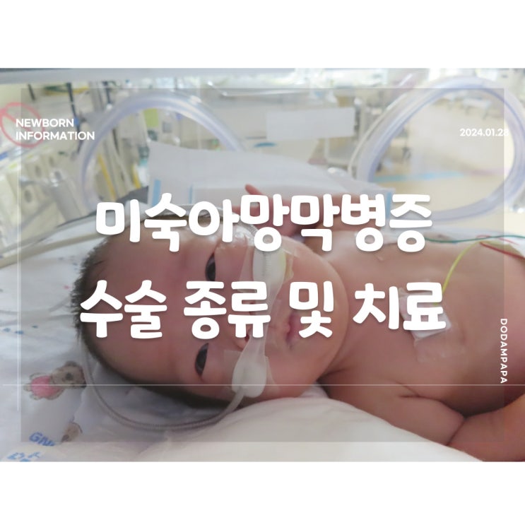 신생아 정보 미숙아망막병증 수술 치료 종류 신생아 정보 미숙아망막병증 수술 치료 종류