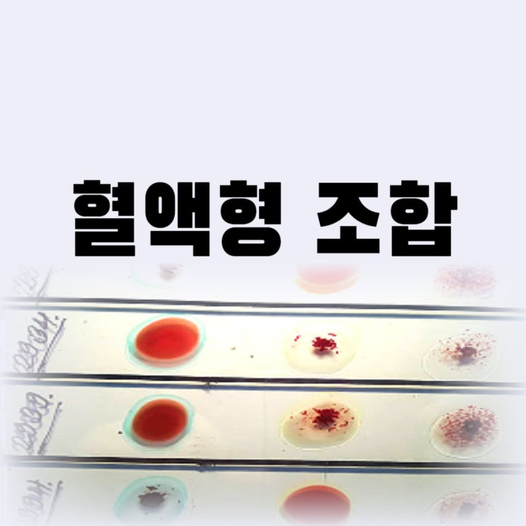  혈액형 유전 조합 수혈 확인하는 방법은