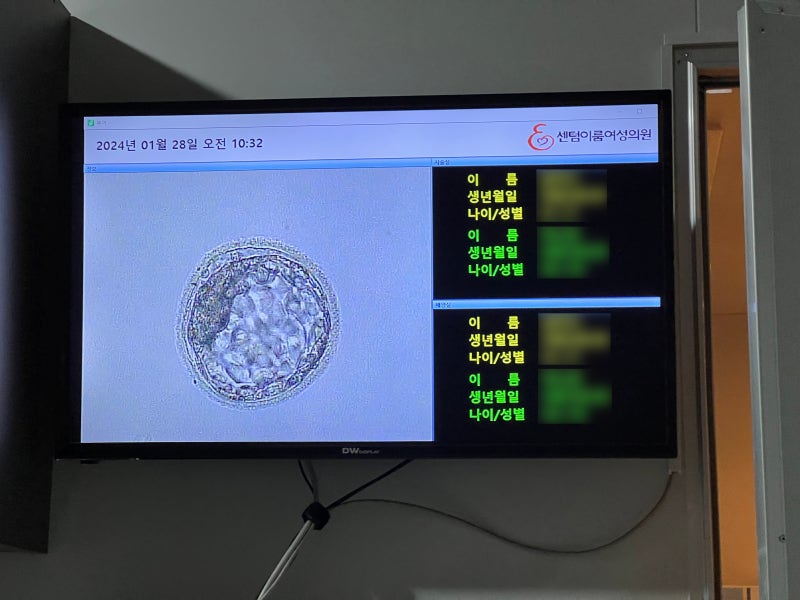 시험관 배아이식 효과, 가격, 맞는 시간