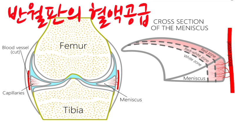 무릎 반월판 손상(tear of meniscus) 원인, 증상 및 맥머레이 검사(mcmurray test) : 네이버 블로그