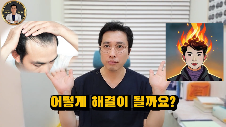  부산탈모내과 아닌 한의원을 선호하는 이유는