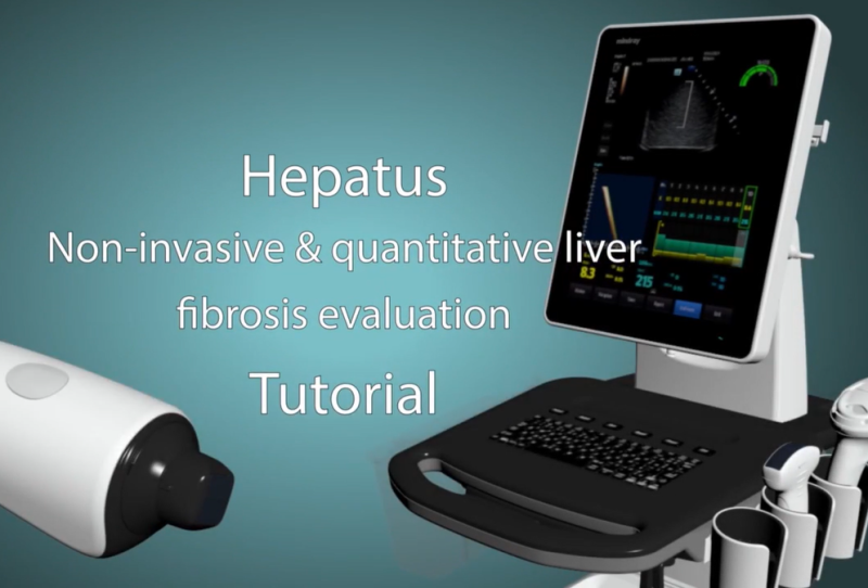 간섬유화·지방간 측정장비(Hepatus) : Hepatus 튜토리얼 영상 : 네이버 블로그