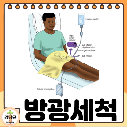 bladder irrigation 방광세척 지속적방광세척 하는방법
