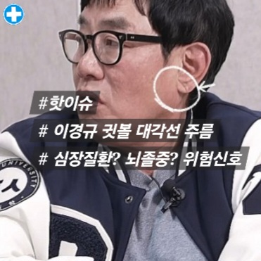 이경규귓볼 대각선주름 치매 심혈관질환 이슈