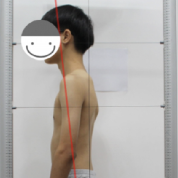 굽은 어깨, 라운드 숄더가 있다면 주목하세요! (원인, 증상, 체형교정 방법)