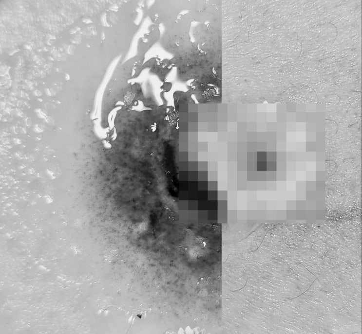  유륜 재건 디테일 몽고메리 결절 질감 기법, 2월 파격 용띠 이벤트 소식