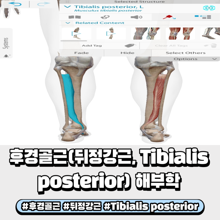  후경골근 뒤정강근 Tibialis posterior 기시점, 정지점, 기능 공부해 봅시다