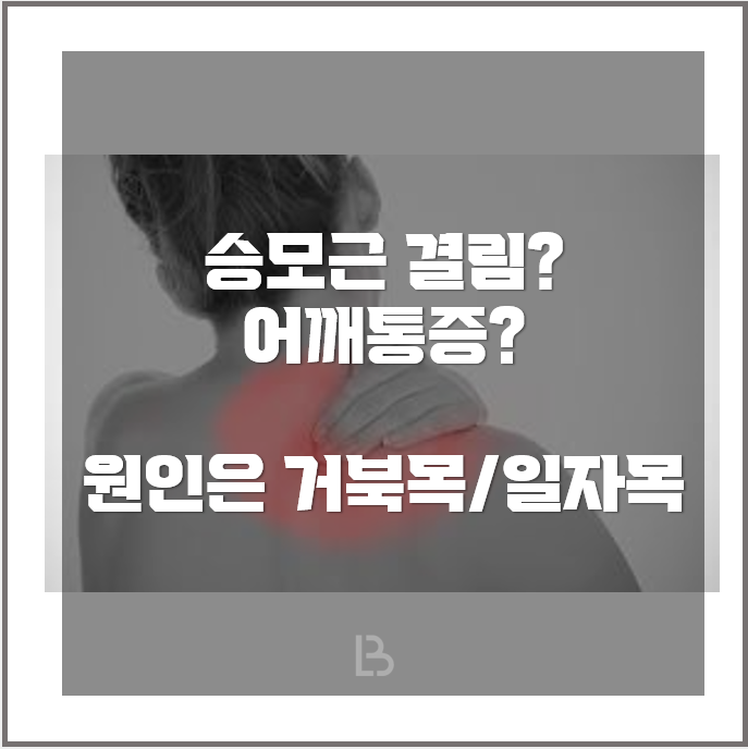  더밸런스랩 신설동 PT 승모근 결림의 원인은? 거북목/일자목