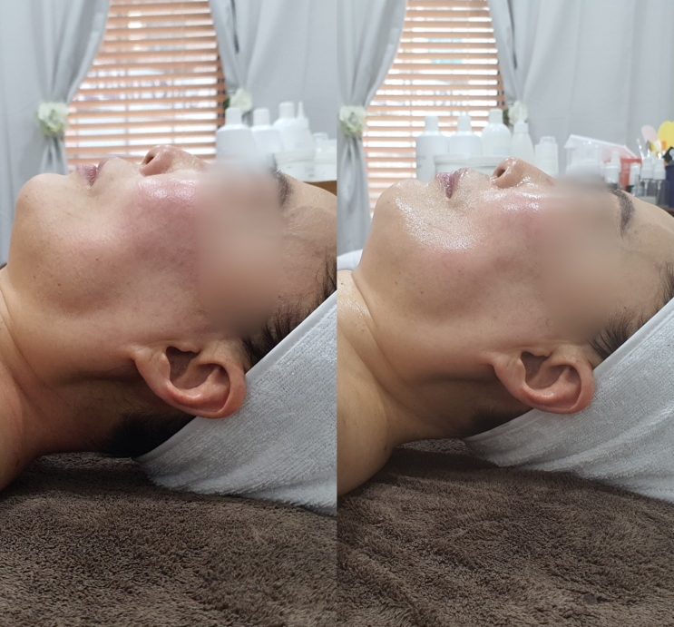  인천송도피부관리 다온에스테틱에서 수분충전 완료!