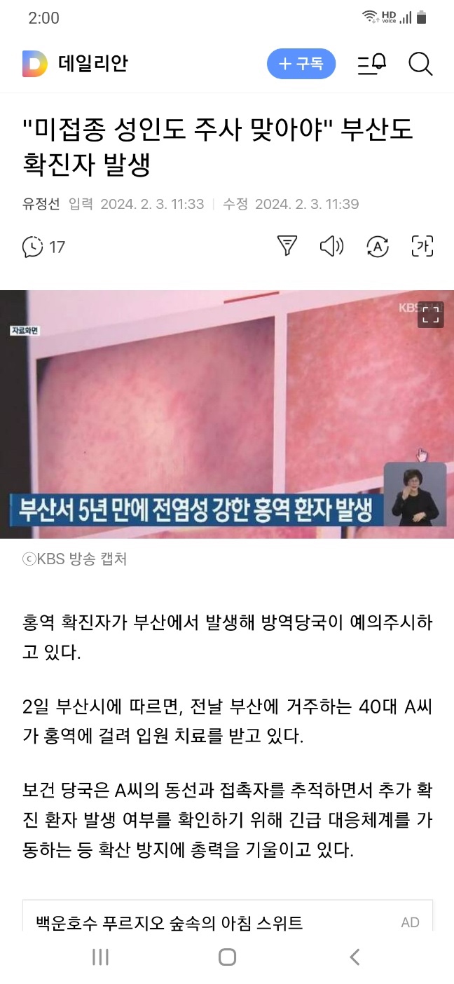 <b>부산</b>에서 5년만에 전염성 강한 <b>홍역환자</b> 발생