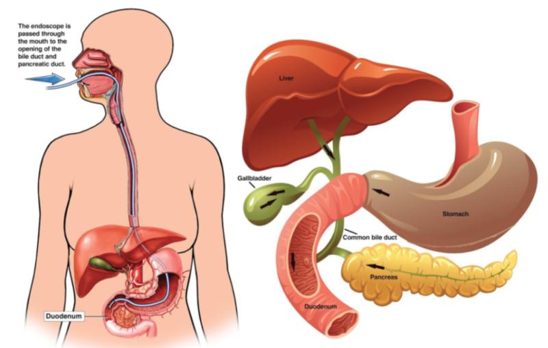 의학용어 ERCP :: 췌담도내시경 정의, 목적, 주의사항 & ENBD ENPD ERBD : 네이버 블로그