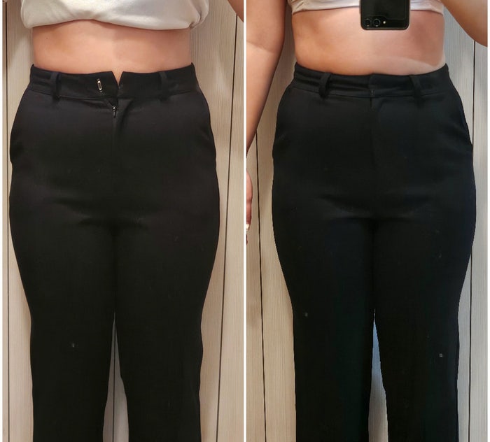  일주일 만에 1.1.kg 인천 구월동 피부과 다이어트 2주차