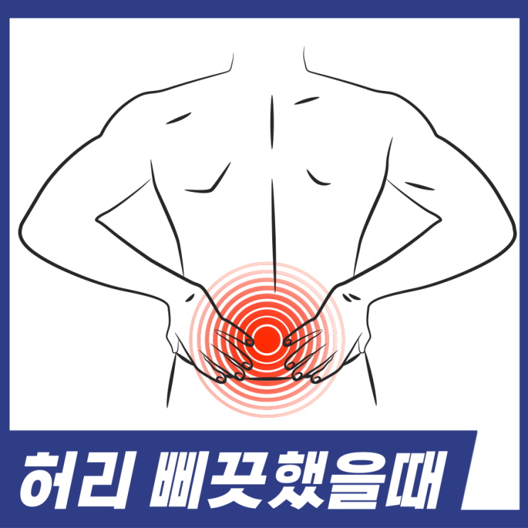  허리 삐끗했을때! 냉찜질 온찜질 응급처치 4가지 알고가세요.