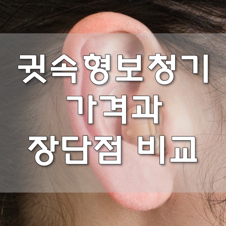  귓속형보청기 가격 과 장단점 비교