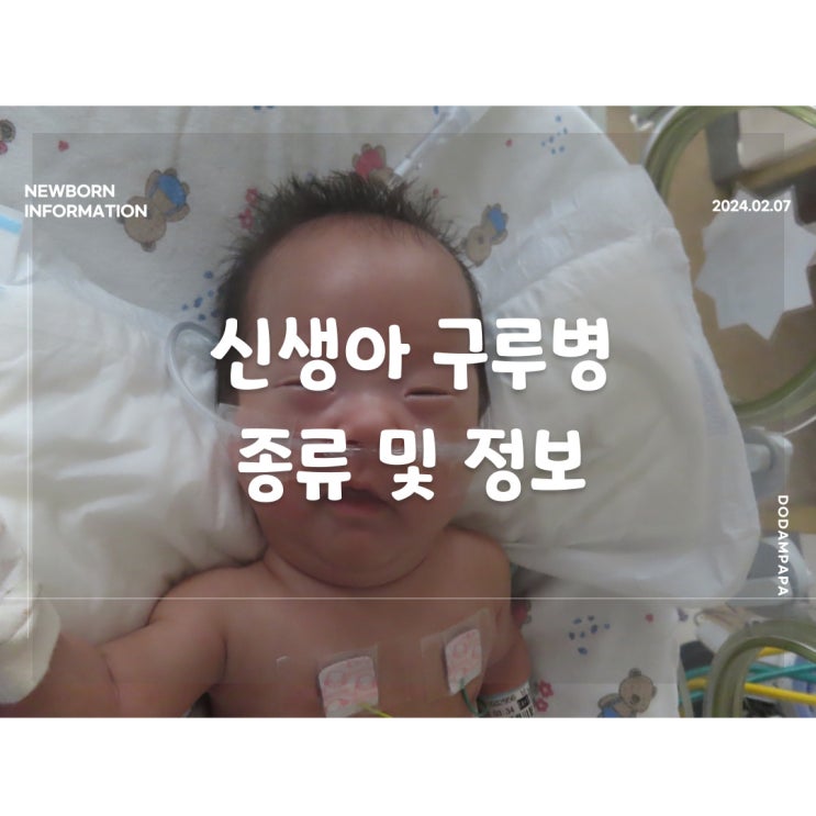 신생아 정보 신생아 구루병 종류 및 정보 신생아 정보 신생아 구루병 종류 및 정보