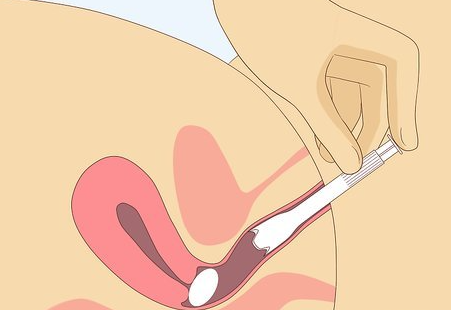 지노프로질정 사용법 및 효과 효능 정확하게 알고 사용하자