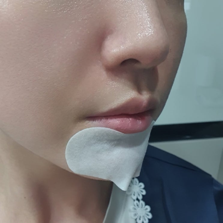  블랙헤드 제거 방법 저자극 녹이는 코팩