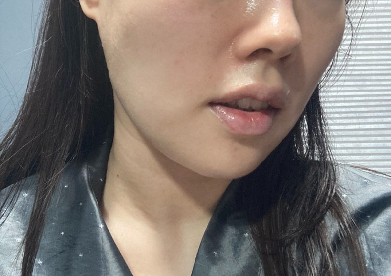 카라에스테틱 이미지