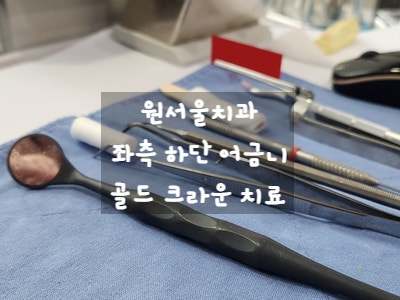  [가산디지털단지 치과] 원서울치과(제이플라츠 4층)에서 왼쪽 아래 어금니 골드 크라운 치료 및 가격 내 돈 내산 2024.01.03