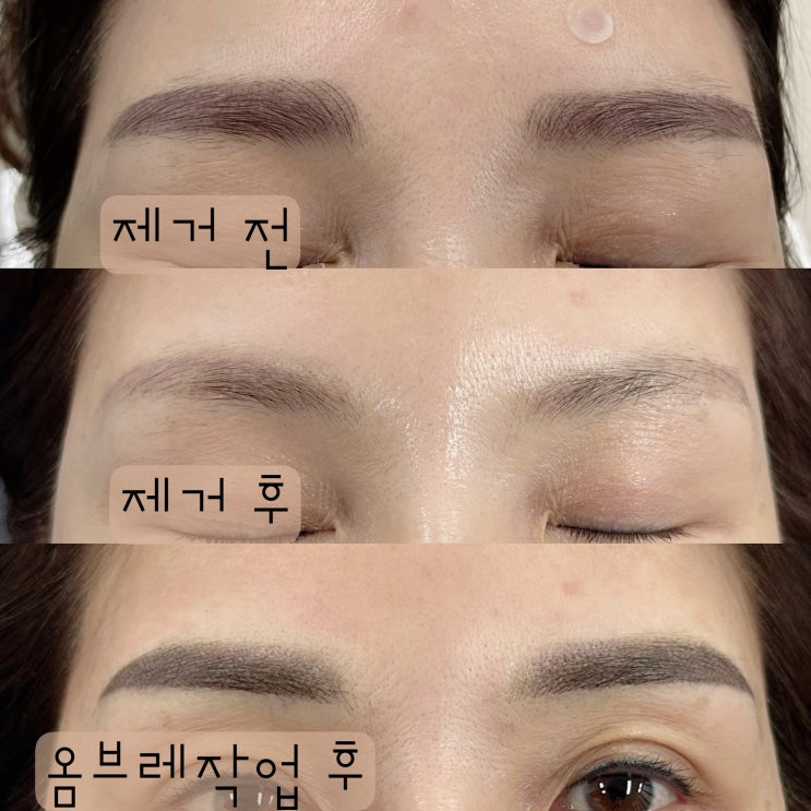  천안 눈썹 문신, 시술 후 망하지 않는 방법!