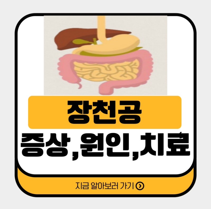 장천공 증상, 원인, 진단 및 치료, 위험군, 예방법