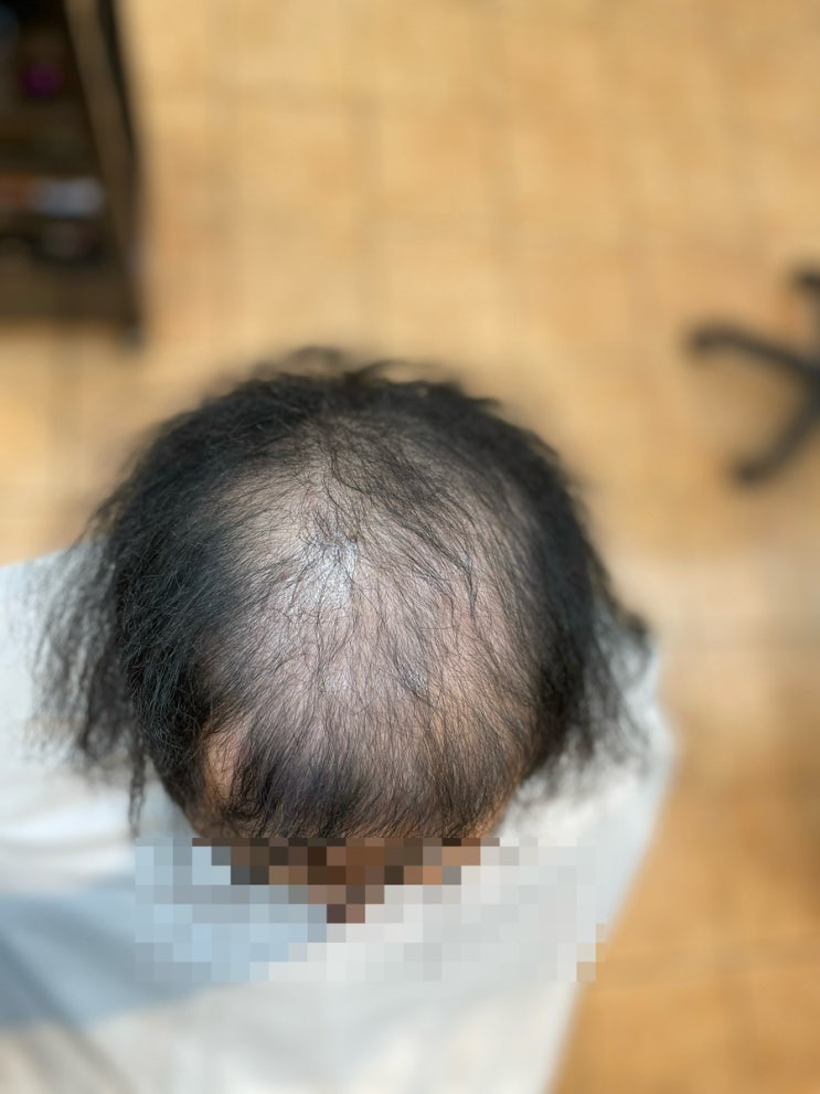  기적의 탈모성형펌 시술 후 부산사상르네시떼미용실[감전괘법주례하단학장다대명지김해대저화명녹산장유울산양산덕계밀양경주사천진주거제마산창원용원진해하동해운대광안리수영남천민락동래명륜양정연제안락]