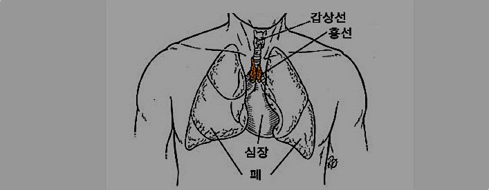 흉선암, 증상과 치료법 자세히 알아보기 : 네이버 블로그