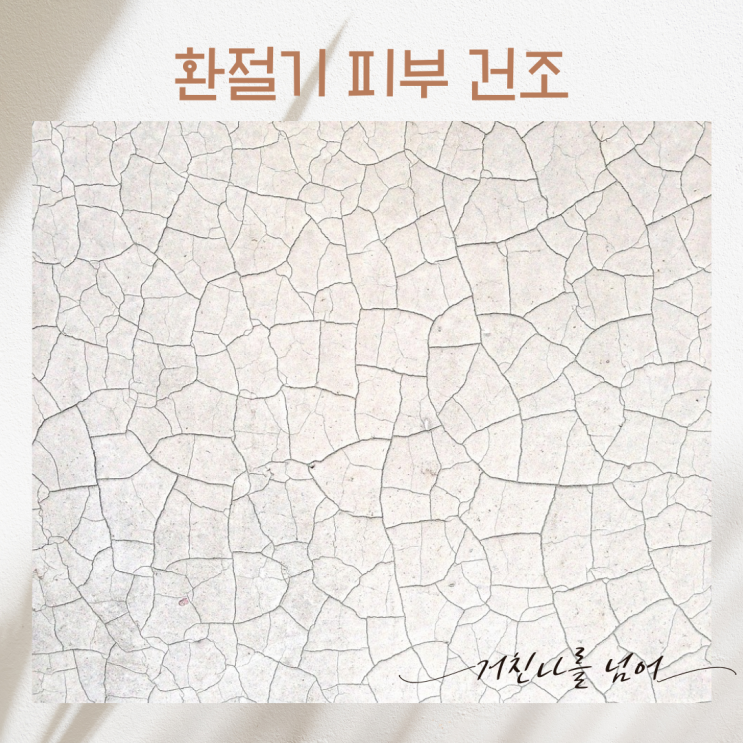  환절기에 나타나는 피부건조, 도대체 환절기마다 피부는 왜 건조해지는 걸까? 피부건조의 원인과 환절기 피부 건조 예방법